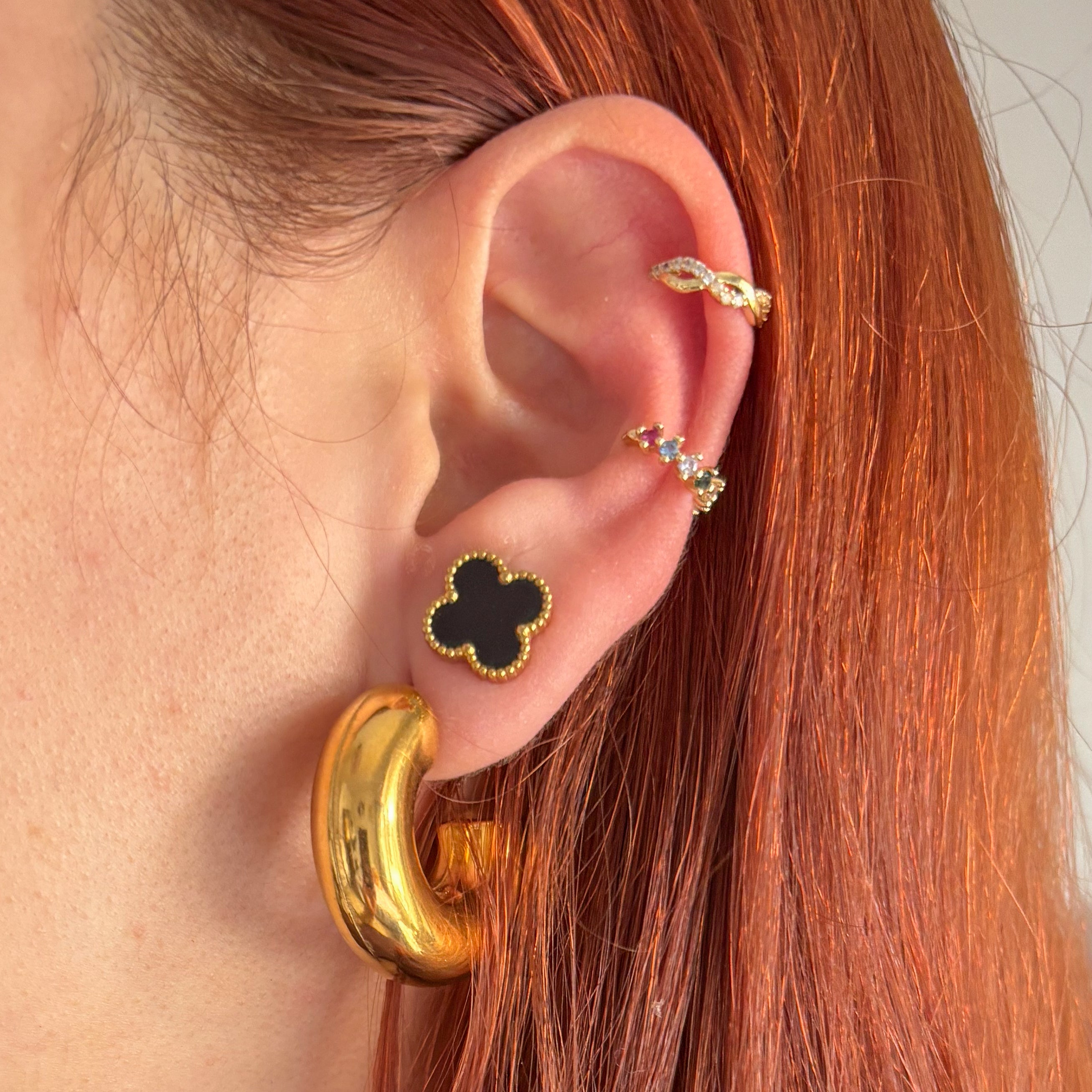 Aretes